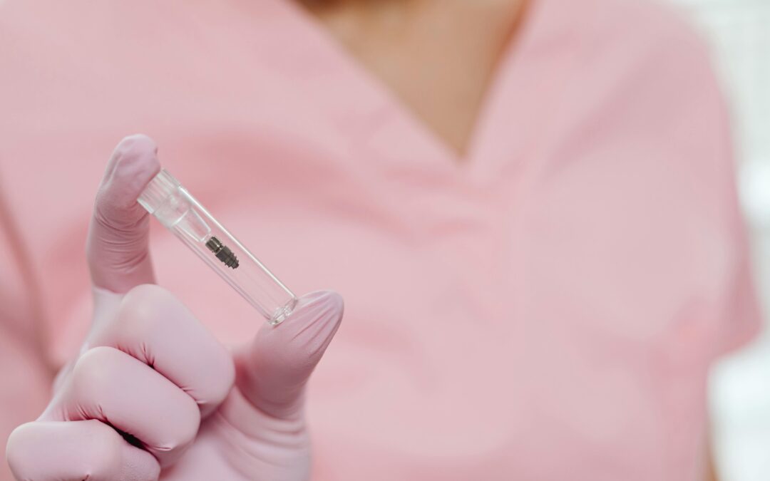 How Long Does a Dental Implant Last? A Guide for Patients in Newry